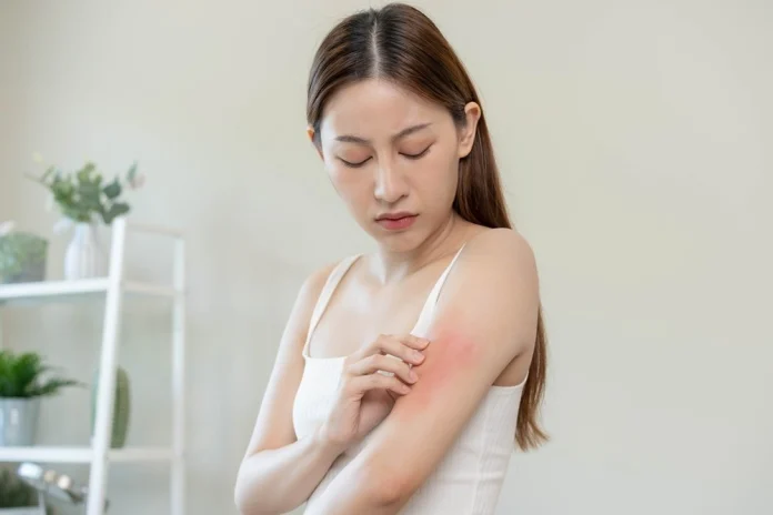 Problem with Itchy Skin